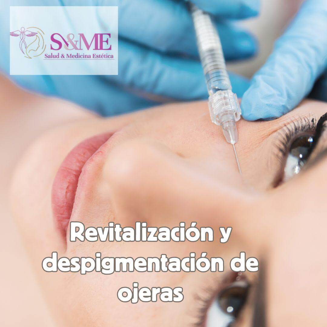 Ácido hialurónico en mentón y mandíbula